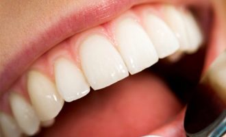 Ushqimet më të mira për shëndetin e dhëmbëve