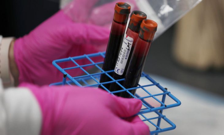 Testi i gjakut mund të përcaktojë rastet e rënda të COVID-19 dhe rrezikun e vdekjes – thotë studimi