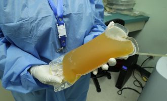 Në SHBA miratohet përdorimi i plazmës së gjakut për trajtimin e COVID-19