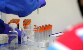 MSH i kundërpërgjigjet Konjufcës rreth akuzave për licencim të laboratorëve privatë për COVID-19