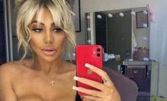 Modelja thotë se humbi shikimin pasi qëndroi për shumë gjatë në telefon