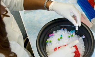 Ilaçet për presionin e gjakut ulin rrezikun e vdekjes nga COVID-19, thotë studimi