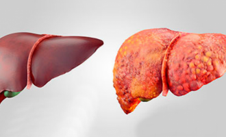 Ushqimet kryesore për shëndetin e mëlçisë që do të ju ndihmojnë të përmirësoni shëndetin e të rrisni jetëgjatësinë