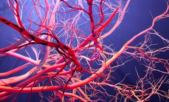 Një mënyrë natyrale për enët e bllokuara të gjakut