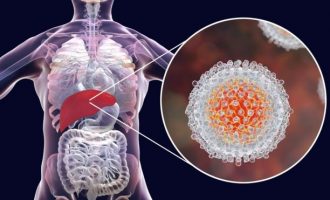 Zbuluesit e Hepatit C fitojnë Çmimin Nobel për mjekësi