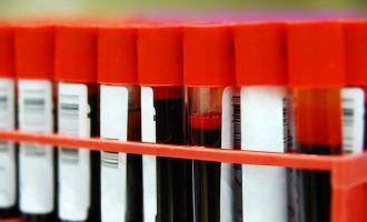 Njerëzit me grupin e gjakut 0 mund të jenë më pak të rrezikuar nga Covid, thonë studimet e reja