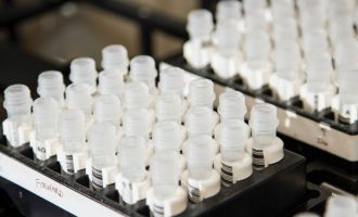 Transplantet e fekaleve mund të jenë ‘burimi i rinisë’ për funksionimin kognitiv