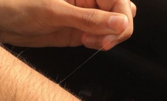 Pse disa qime në trupin tonë zgjaten në mënyrë absurde?