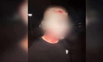 Flet 19-vjeçari që u rrah nga Policia në Mitrovicë për shkelje të orës policore