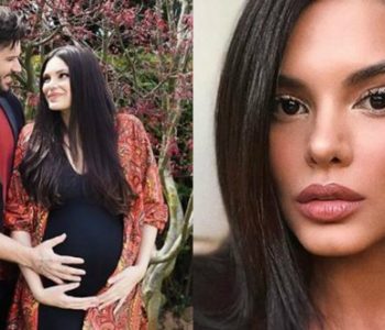 Faza më e bezdisshme e Almedës gjatë pritjes së ëmbël – Ç’duhet të dimë për aknet e shtatzënisë?