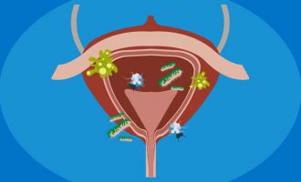 Vdekja e aktores së njohur: A mund të jenë fatale për jetë infeksionet e traktit urinar?