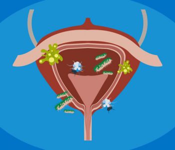 Vdekja e aktores së njohur: A mund të jenë fatale për jetë infeksionet e traktit urinar?