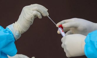 Jo më në hundë – Kina po përdor tamponë analë për të testuar COVID-19