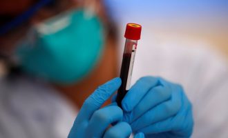 Rreth 40 plazma gjaku të dhuruara nga pacientët që kanë kaluar COVID-19