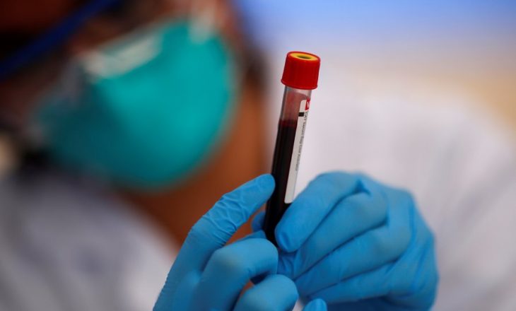 Rreth 40 plazma gjaku të dhuruara nga pacientët që kanë kaluar COVID-19