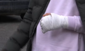 Një person thotë së një polic i Kosovës ia theu dorën