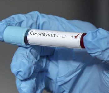 Këngëtari i njohur u vaksinua për COVID-19 por doli sërish pozitiv me virus