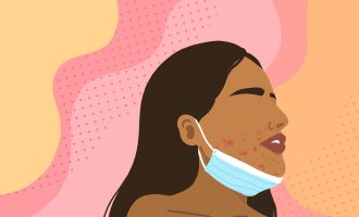 Pse mbajtja e maskës për një kohë të gjatë shkakton akne?