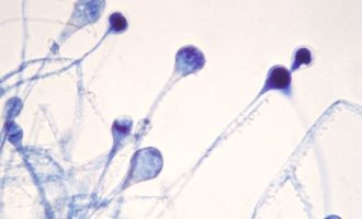 India me afër 9,000 raste të sëmundjes “kërpudhat e zeza”, pritet të shpallet epidemi