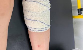 Qentë endacakë sulmojnë djalin e Mimoza Kusari-Lila