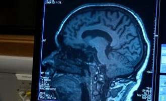 SHBA-të aprovojnë ilaçin i cili pritej që 20 vjet