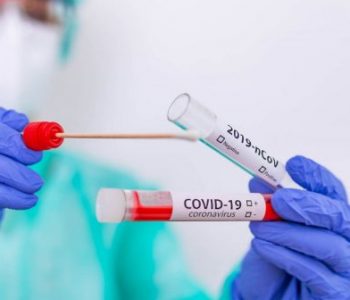 Falsifikonin teste për COVID-19, arrestohen pronari dhe punëtorja e laboratorit në Podujevë