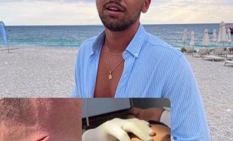 Yll Limani aksidentohet gjatë pushimeve në Shqipëri, përfundon në spital