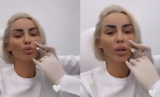 Pas lirimit nga paraburgimi, Fjolla Morina iu nënshtrohet ndërhyrjeve estetike